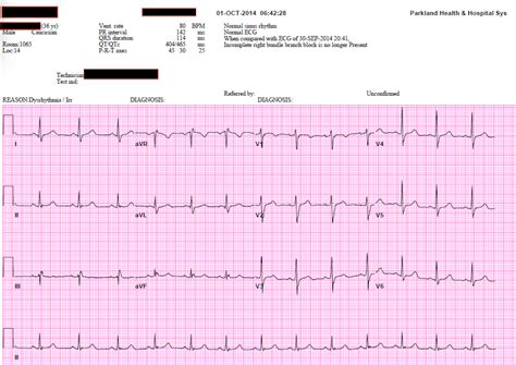 chloe ecg torrent|ecg exam template.